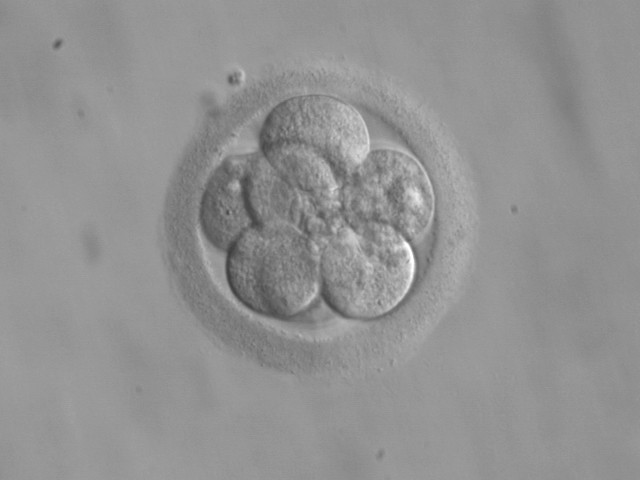 1920_embryo-8-cells.jpg