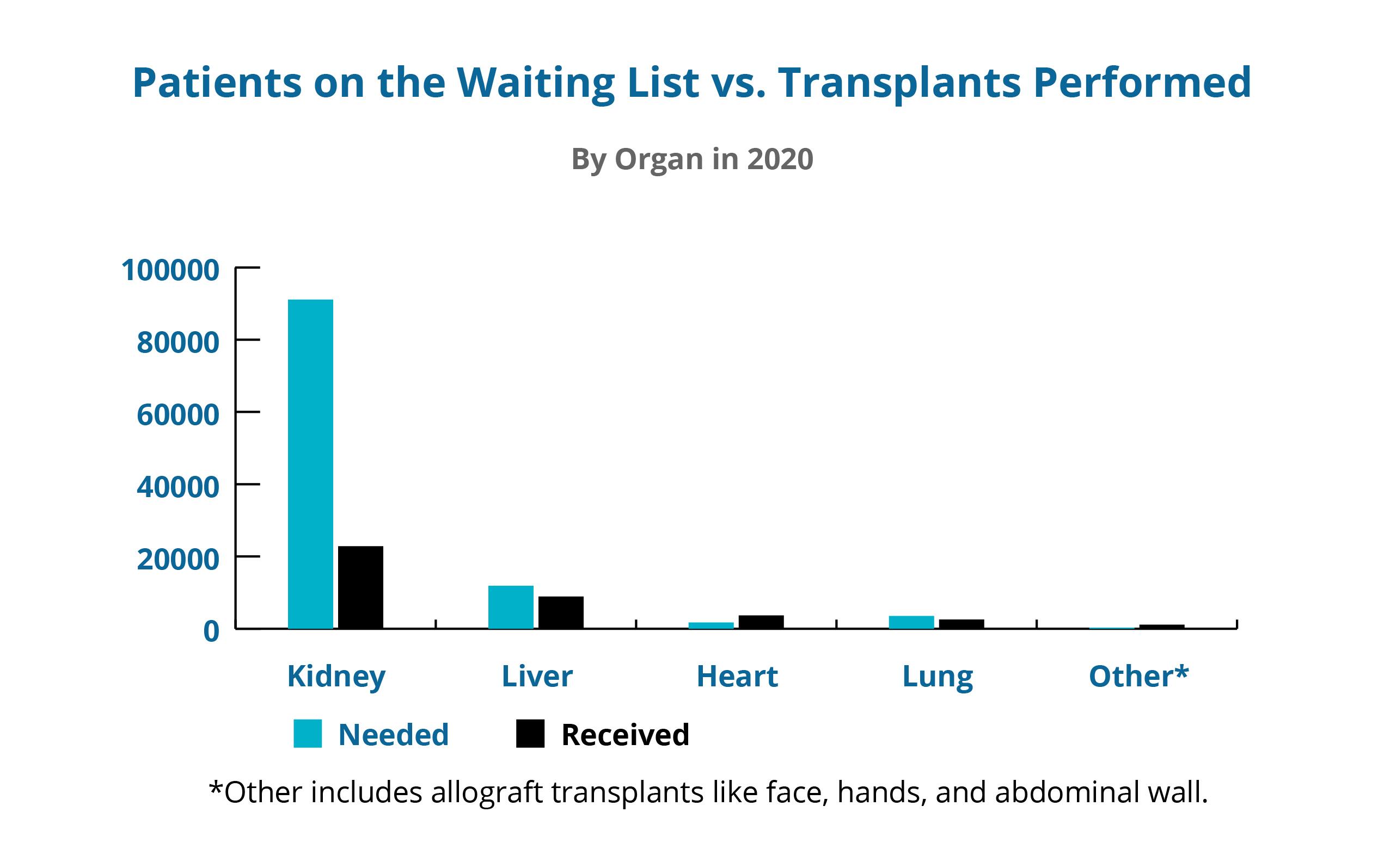 waiting-vs-trans-organ-1.jpg